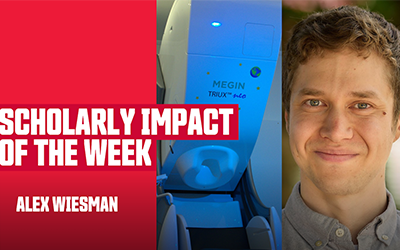 Cutting-Edge Research Advances Understanding of Parkinson’s Treatment at SFU