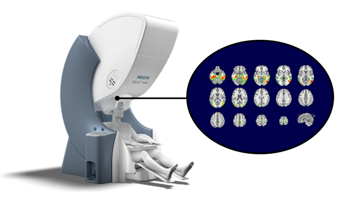 Geneva at the heart of the human brain