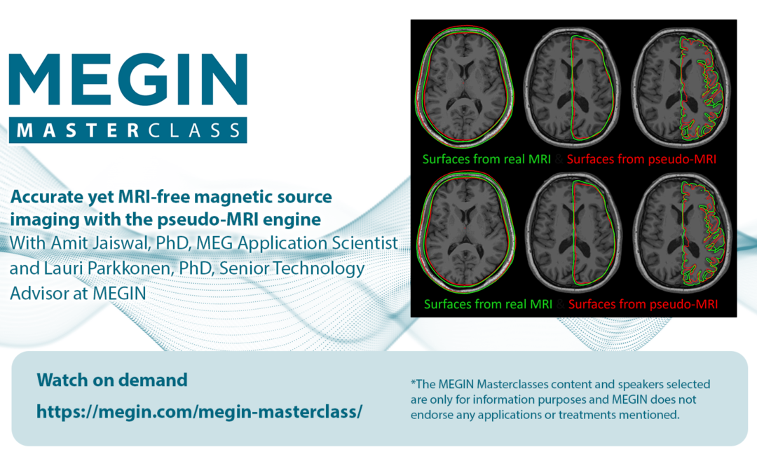 Accurate yet MRI-free magnetic source imaging with the pseudo-MRI engine