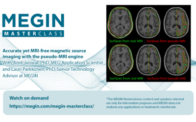 Accurate yet MRI-free magnetic source imaging with the pseudo-MRI engine