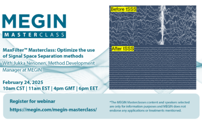 MaxFilter™ Masterclass: Optimize the use of Signal Space Separation methods