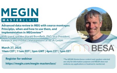 Advanced data review in MEG with source montages: Principles, when and how to use them, and implementation in MEGreviewTM